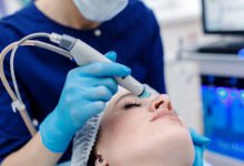 Hydrafacial in Tysons Corner, VA treatment being performed by a skincare professional using advanced HydraFacial technology to cleanse, exfoliate, and hydrate the skin.