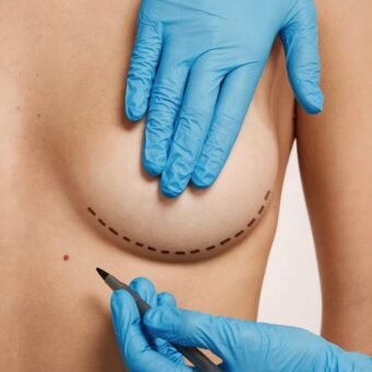 Breast Lift in Dubai