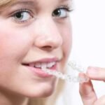dental braces cost in chennai