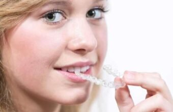 dental braces cost in chennai
