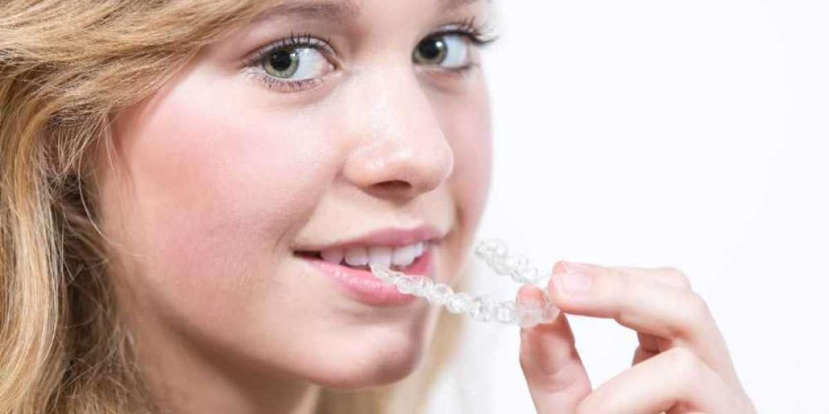 dental braces cost in chennai